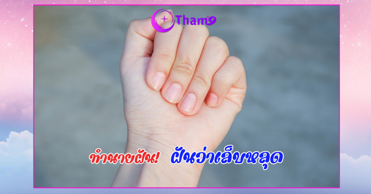 ฝันว่าเล็บหลุด
